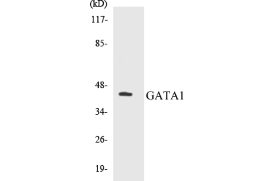 Western Blot - GATA1 Cell Based ELISA Kit (CB5289) - Antibodies.com