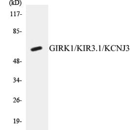 Western Blot - GIRK1 Cell Based ELISA Kit (CB5293) - Antibodies.com