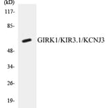 Western Blot - GIRK1 Cell Based ELISA Kit (CB5293) - Antibodies.com
