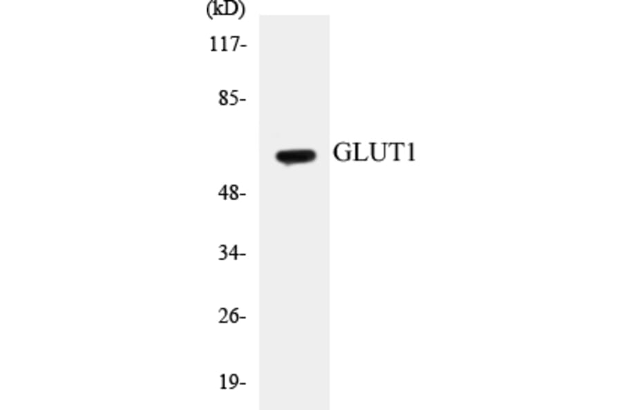 Western Blot - GLUT1 Cell Based ELISA Kit (CB5299) - Antibodies.com