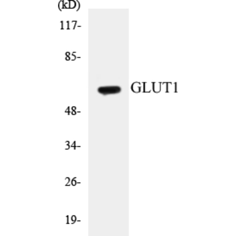Western Blot - GLUT1 Cell Based ELISA Kit (CB5299) - Antibodies.com
