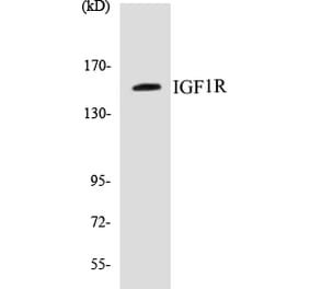 Western Blot - IGF1R Cell Based ELISA Kit (CB5355) - Antibodies.com
