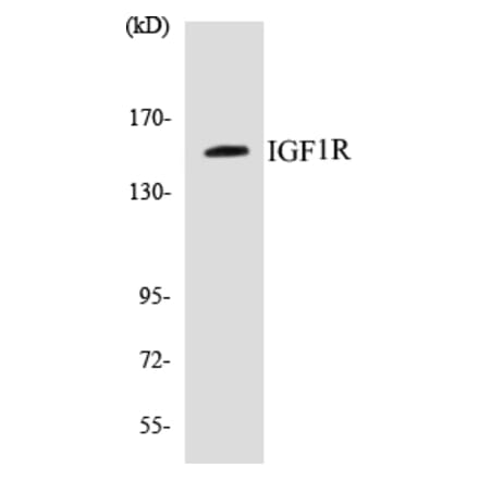Western Blot - IGF1R Cell Based ELISA Kit (CB5355) - Antibodies.com