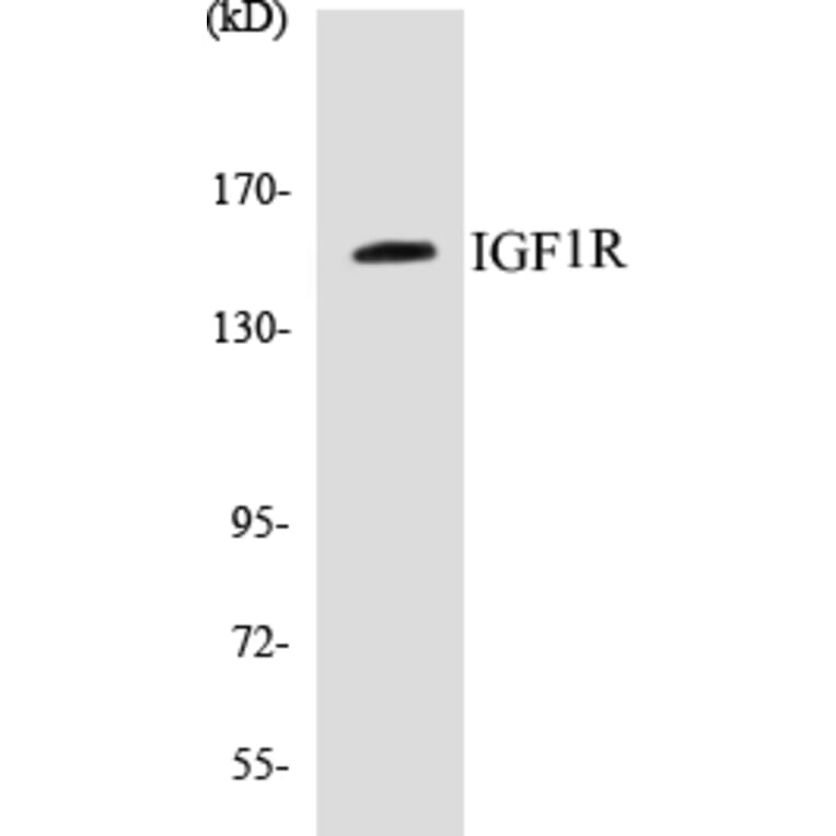 Western Blot - IGF1R Cell Based ELISA Kit (CB5355) - Antibodies.com