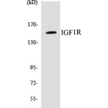 Western Blot - IGF1R Cell Based ELISA Kit (CB5355) - Antibodies.com