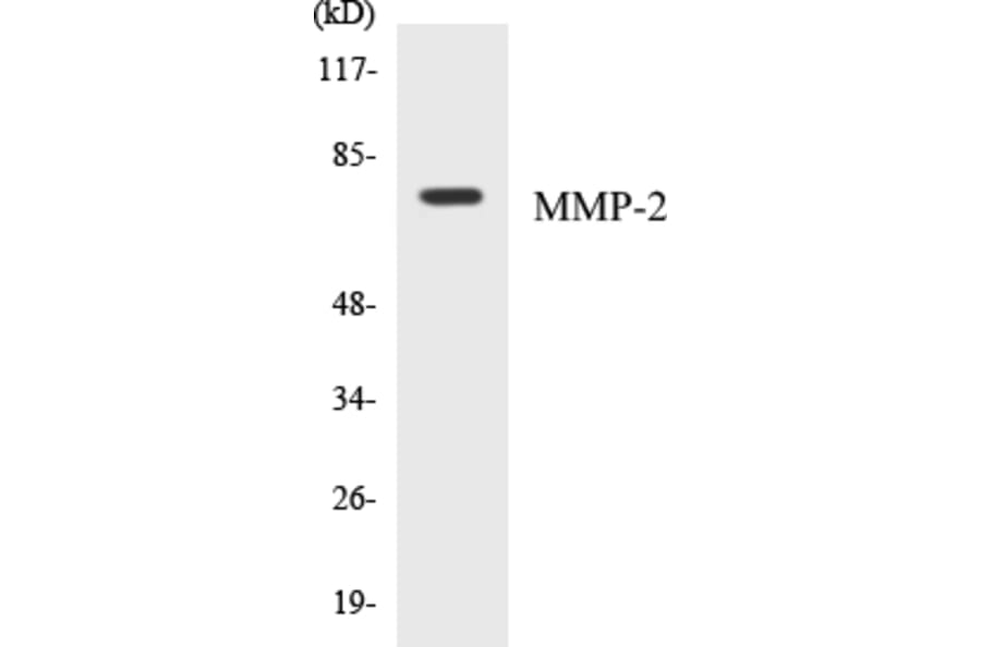 Western Blot - MMP-2 Cell Based ELISA Kit (CB5462) - Antibodies.com