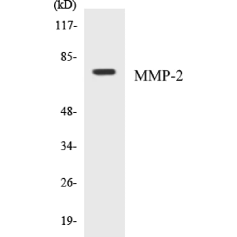 Western Blot - MMP-2 Cell Based ELISA Kit (CB5462) - Antibodies.com