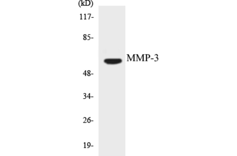 Western Blot - MMP-3 Cell Based ELISA Kit (CB5464) - Antibodies.com