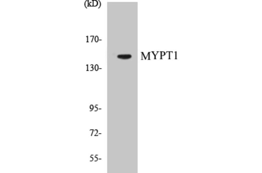 Western Blot - MYPT1 Cell Based ELISA Kit (CB5479) - Antibodies.com