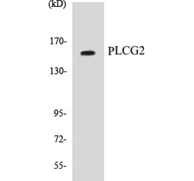 Western Blot - PLCG2 Cell Based ELISA Kit (CB5575) - Antibodies.com