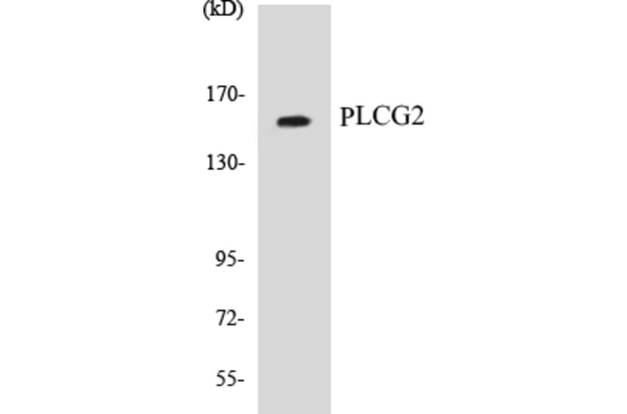 Western Blot - PLCG2 Cell Based ELISA Kit (CB5575) - Antibodies.com