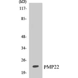 Western Blot - PMP22 Cell Based ELISA Kit (CB5579) - Antibodies.com