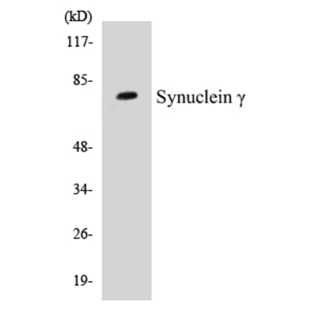 Western Blot - SENP2 Cell Based ELISA Kit (CB5621) - Antibodies.com