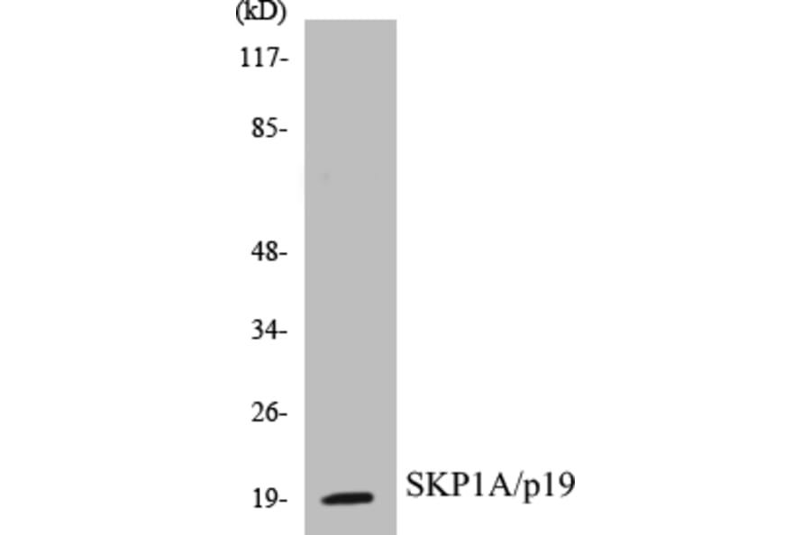 Western Blot - SKP1A Cell Based ELISA Kit (CB5634) - Antibodies.com
