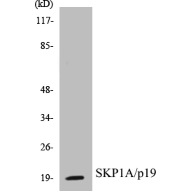Western Blot - SKP1A Cell Based ELISA Kit (CB5634) - Antibodies.com