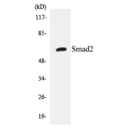 Western Blot - Smad2 Cell Based ELISA Kit (CB5638) - Antibodies.com