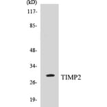 Western Blot - TIMP2 Cell Based ELISA Kit (CB5691) - Antibodies.com
