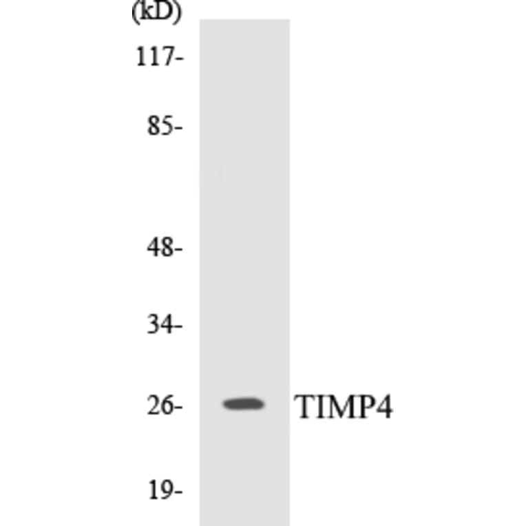 Western Blot - TIMP4 Cell Based ELISA Kit (CB5693) - Antibodies.com