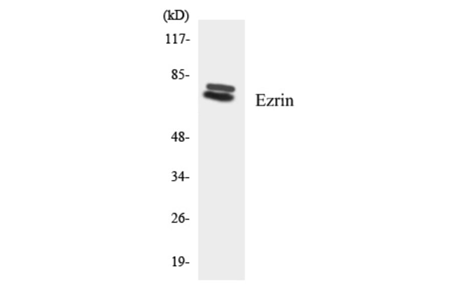 Western Blot - Ezrin Cell Based ELISA Kit (CB5745) - Antibodies.com