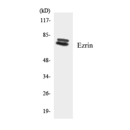 Western Blot - Ezrin Cell Based ELISA Kit (CB5745) - Antibodies.com