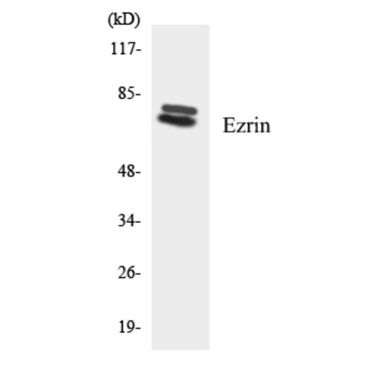 Western Blot - Ezrin Cell Based ELISA Kit (CB5745) - Antibodies.com