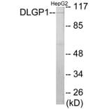 Western Blot - DLGP1 Cell Based ELISA Kit (CB5767) - Antibodies.com