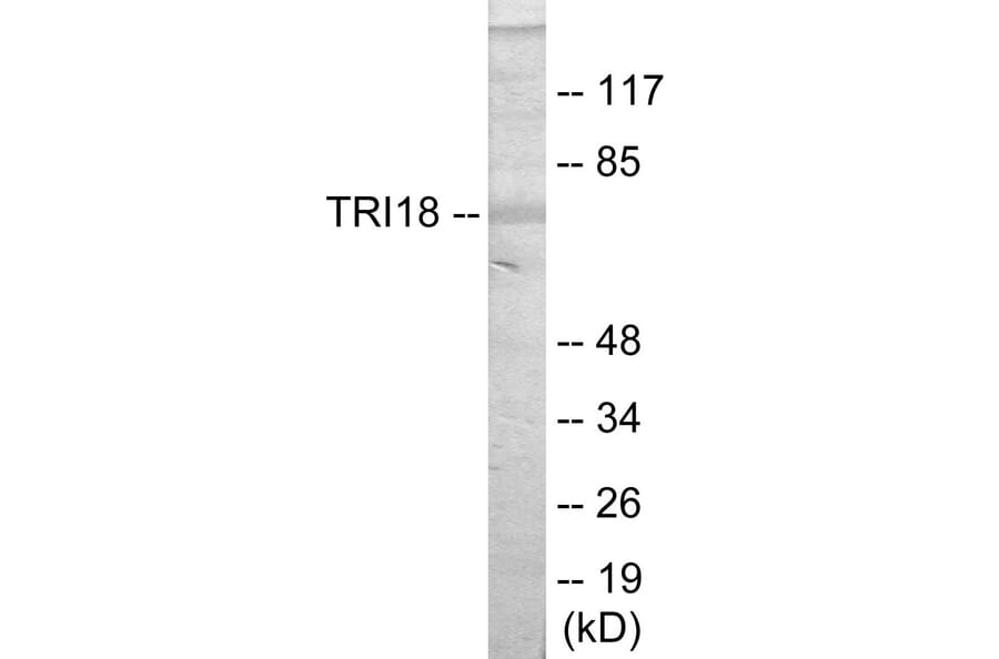Western Blot - TRI18 Cell Based ELISA Kit (CB5777) - Antibodies.com