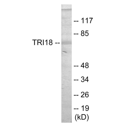 Western Blot - TRI18 Cell Based ELISA Kit (CB5777) - Antibodies.com