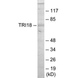 Western Blot - TRI18 Cell Based ELISA Kit (CB5777) - Antibodies.com