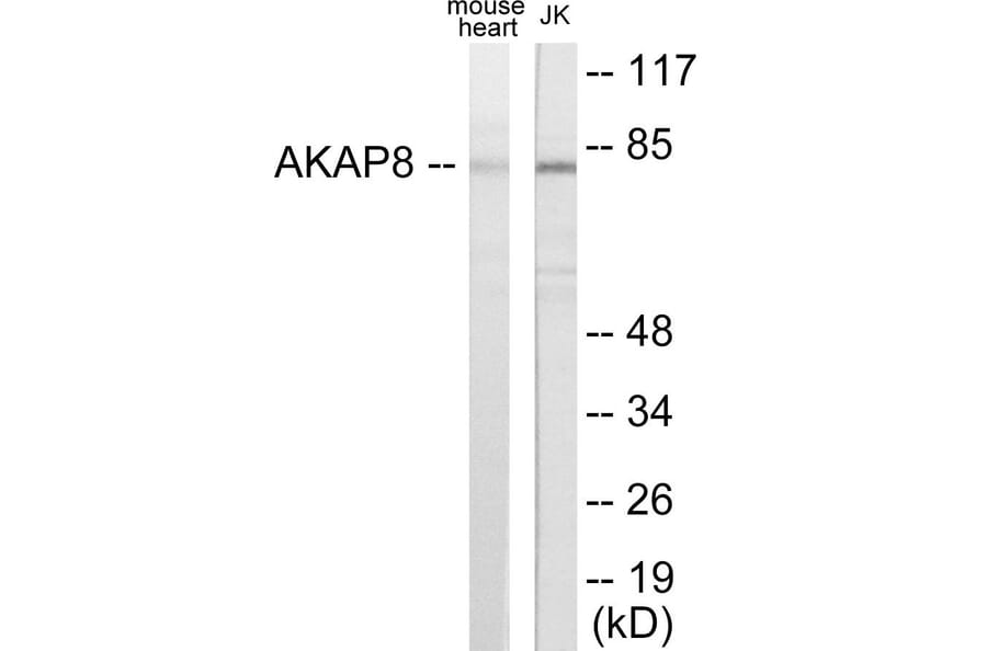 Western Blot - AKAP8 Cell Based ELISA Kit (CB5786) - Antibodies.com