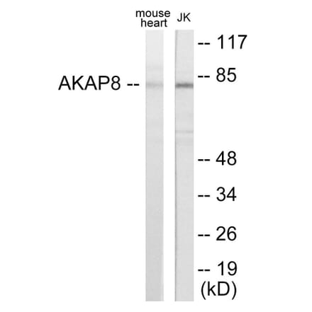 Western Blot - AKAP8 Cell Based ELISA Kit (CB5786) - Antibodies.com