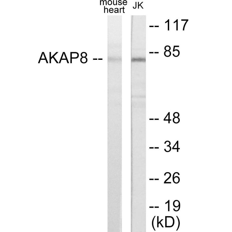 Western Blot - AKAP8 Cell Based ELISA Kit (CB5786) - Antibodies.com