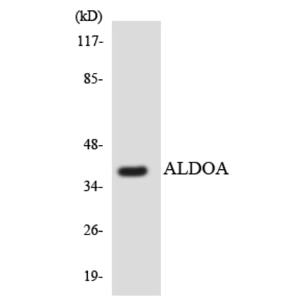 Western Blot - ALDOA Cell Based ELISA Kit (CB5831) - Antibodies.com