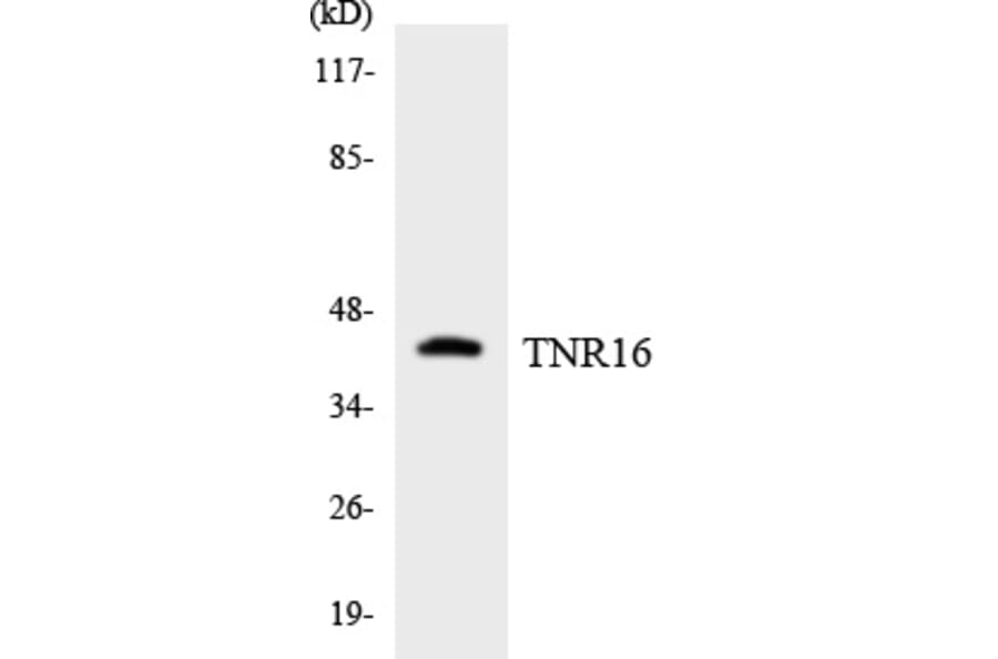 Western Blot - TNR16 Cell Based ELISA Kit (CB5834) - Antibodies.com