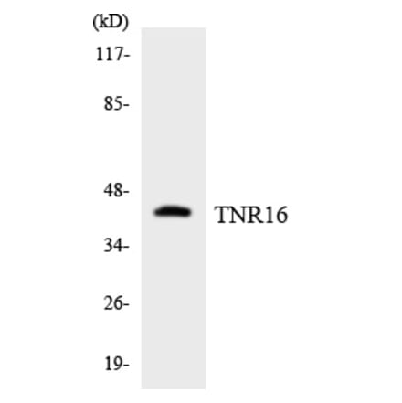 Western Blot - TNR16 Cell Based ELISA Kit (CB5834) - Antibodies.com