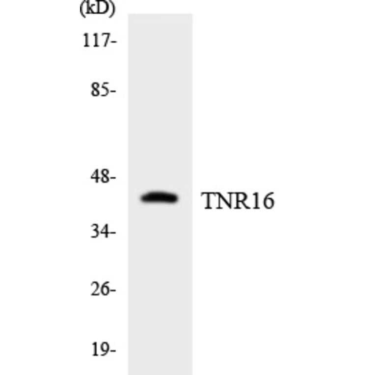 Western Blot - TNR16 Cell Based ELISA Kit (CB5834) - Antibodies.com