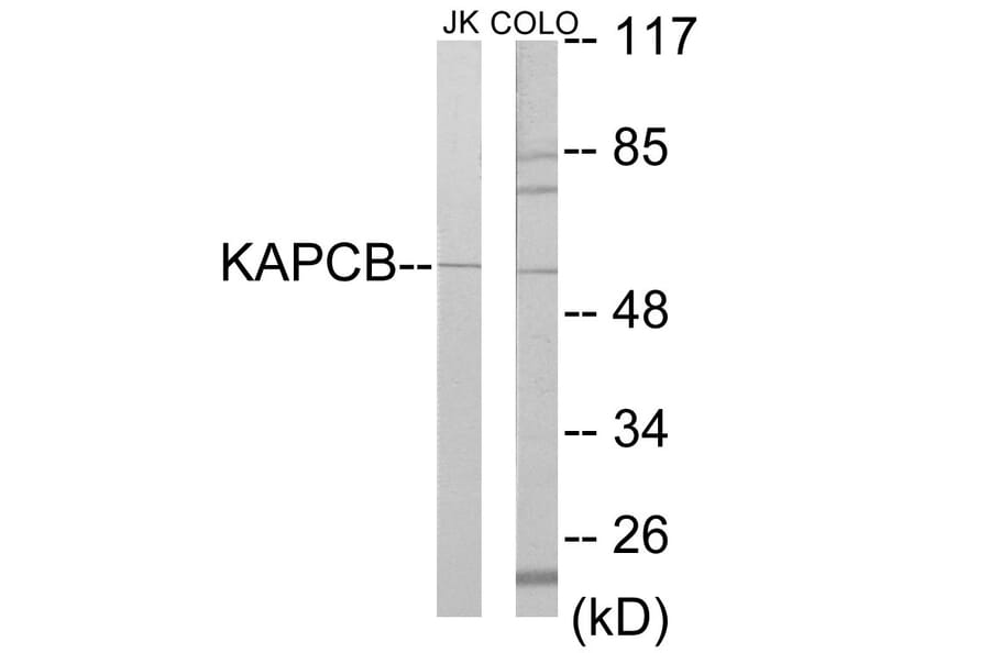 Western Blot - KAPCB Cell Based ELISA Kit (CB5858) - Antibodies.com