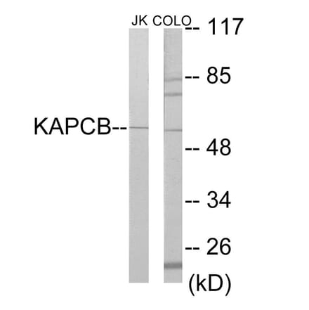 Western Blot - KAPCB Cell Based ELISA Kit (CB5858) - Antibodies.com