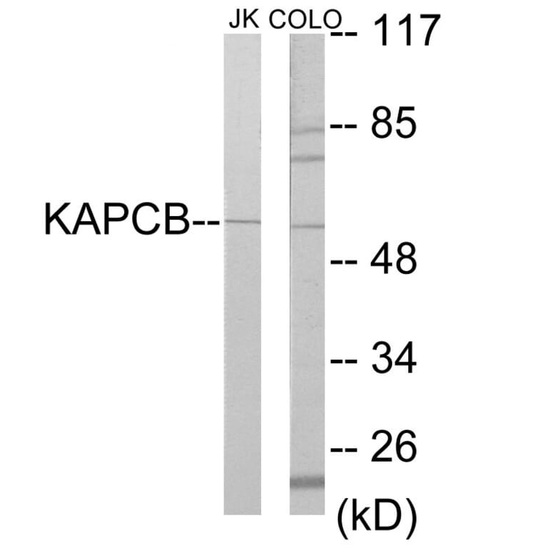 Western Blot - KAPCB Cell Based ELISA Kit (CB5858) - Antibodies.com