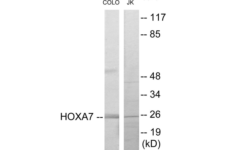 Western Blot - HOXA7 Cell Based ELISA Kit (CB5874) - Antibodies.com
