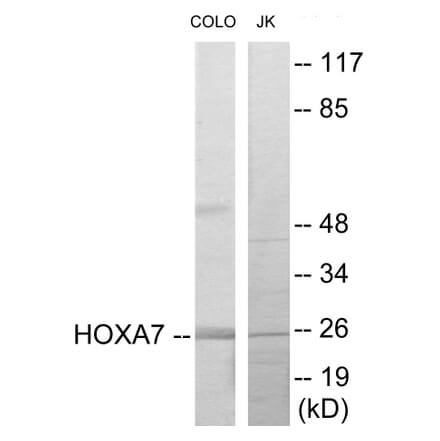 Western Blot - HOXA7 Cell Based ELISA Kit (CB5874) - Antibodies.com