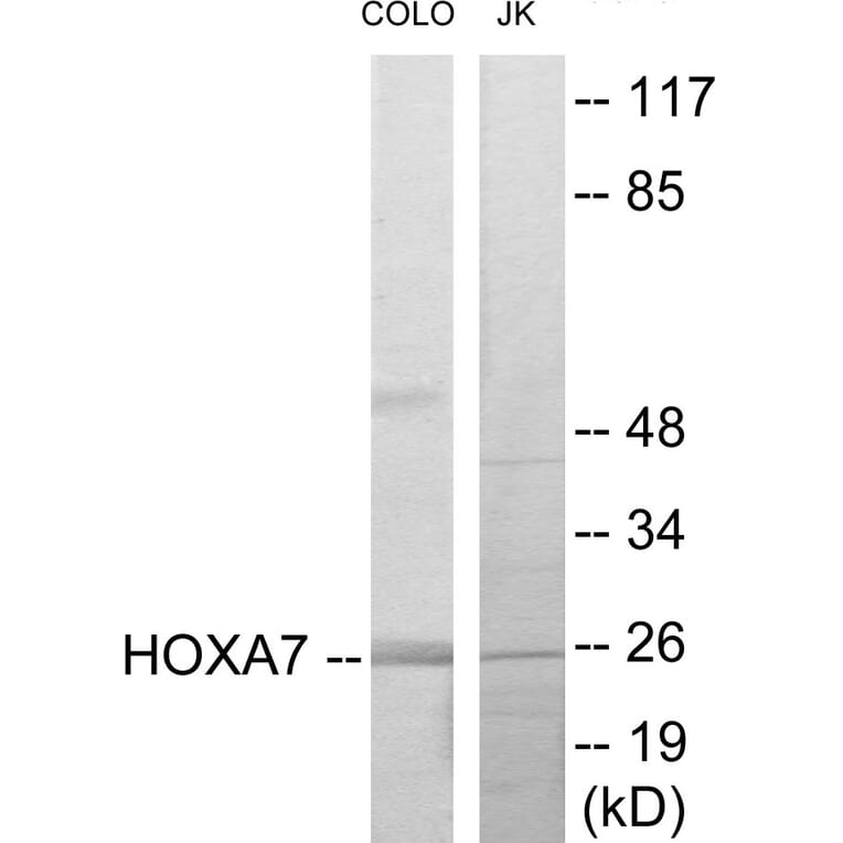Western Blot - HOXA7 Cell Based ELISA Kit (CB5874) - Antibodies.com