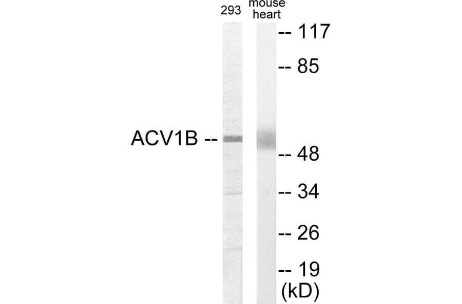 Western Blot - ACV1B Cell Based ELISA Kit (CB5884) - Antibodies.com