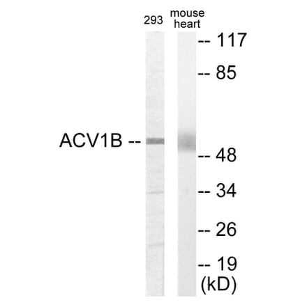 Western Blot - ACV1B Cell Based ELISA Kit (CB5884) - Antibodies.com