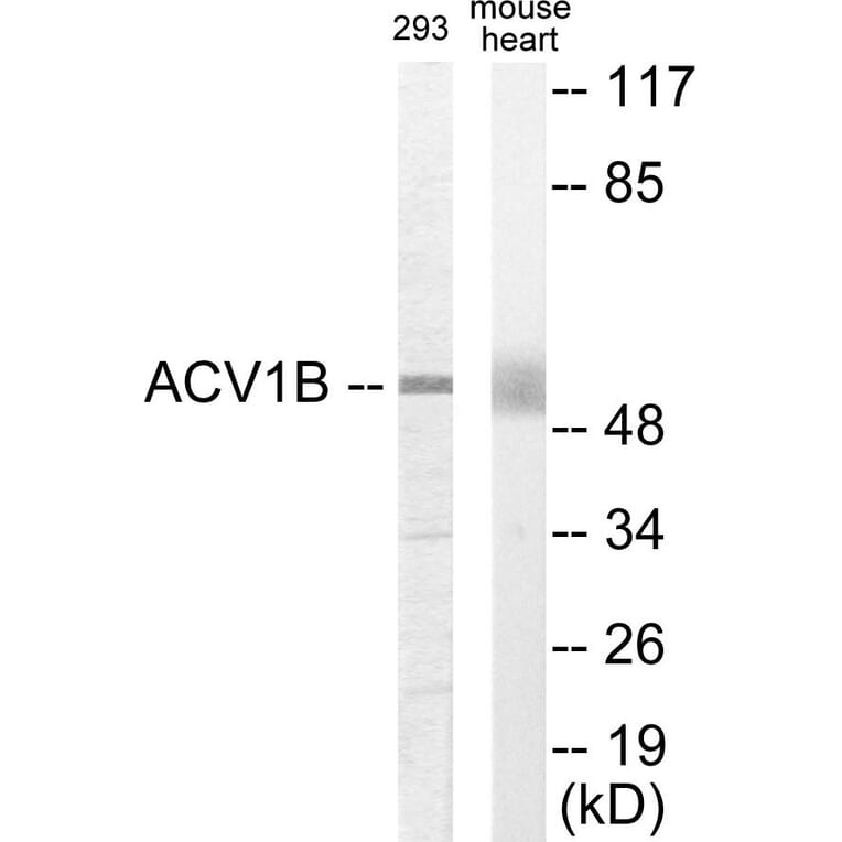Western Blot - ACV1B Cell Based ELISA Kit (CB5884) - Antibodies.com