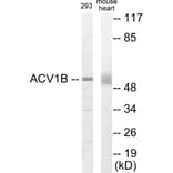 Western Blot - ACV1B Cell Based ELISA Kit (CB5884) - Antibodies.com
