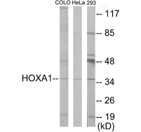 Western Blot - HOXA1 Cell Based ELISA Kit (CB5899) - Antibodies.com