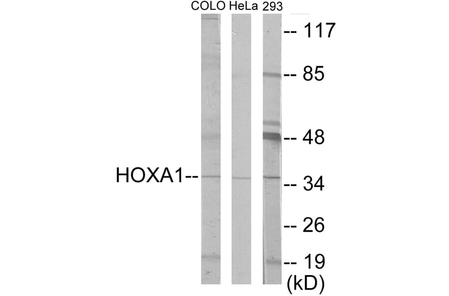 Western Blot - HOXA1 Cell Based ELISA Kit (CB5899) - Antibodies.com