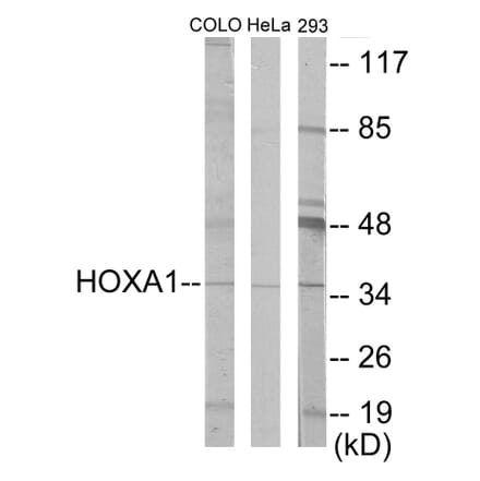 Western Blot - HOXA1 Cell Based ELISA Kit (CB5899) - Antibodies.com