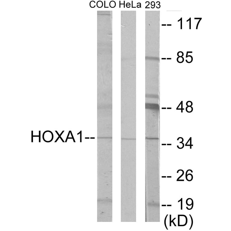 Western Blot - HOXA1 Cell Based ELISA Kit (CB5899) - Antibodies.com